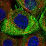 LPIN2 Polyclonal Antibody