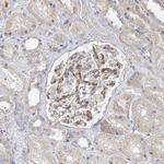 SLC43A3 Antibody in Immunohistochemistry (Paraffin) (IHC (P))