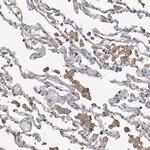 SLC43A3 Antibody in Immunohistochemistry (Paraffin) (IHC (P))