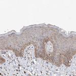 SLC43A3 Polyclonal Antibody