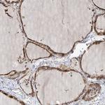 SLC43A3 Antibody in Immunohistochemistry (Paraffin) (IHC (P))