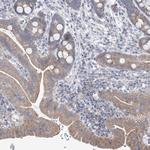 UFL1 Antibody in Immunohistochemistry (Paraffin) (IHC (P))