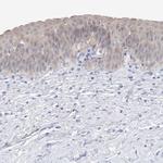 UFL1 Antibody in Immunohistochemistry (IHC)