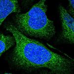 UFL1 Polyclonal Antibody