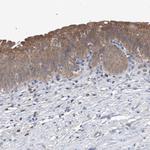 UFL1 Polyclonal Antibody