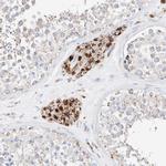 C6orf62 Antibody in Immunohistochemistry (IHC)