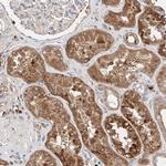 C6orf62 Antibody in Immunohistochemistry (Paraffin) (IHC (P))