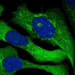 SRBD1 Polyclonal Antibody