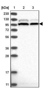 SRBD1 Antibody in Western Blot (WB)