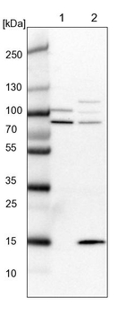 SRBD1 Antibody in Western Blot (WB)
