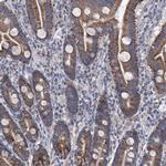 SRBD1 Antibody in Immunohistochemistry (IHC)