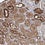 BHE23 Antibody in Immunohistochemistry (Paraffin) (IHC (P))
