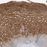 SYTL3 Antibody in Immunohistochemistry (Paraffin) (IHC (P))