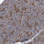 ZNF343 Polyclonal Antibody