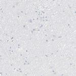 PRSS23 Antibody in Immunohistochemistry (Paraffin) (IHC (P))
