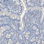 PRSS23 Antibody in Immunohistochemistry (Paraffin) (IHC (P))