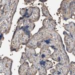 PRSS23 Polyclonal Antibody