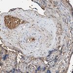 PRSS23 Antibody in Immunohistochemistry (Paraffin) (IHC (P))