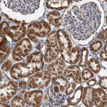 MRPL28 Antibody in Immunohistochemistry (Paraffin) (IHC (P))