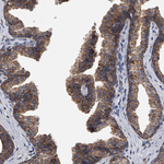 MRPL28 Antibody in Immunohistochemistry (Paraffin) (IHC (P))