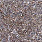 MRPL28 Antibody in Immunohistochemistry (Paraffin) (IHC (P))
