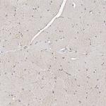 LRRC16B Antibody in Immunohistochemistry (Paraffin) (IHC (P))