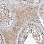 LRRC16B Antibody in Immunohistochemistry (Paraffin) (IHC (P))
