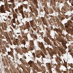 STX19 Antibody in Immunohistochemistry (Paraffin) (IHC (P))