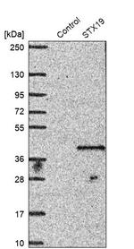 STX19 Antibody in Western Blot (WB)