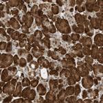ZNF195 Antibody in Immunohistochemistry (Paraffin) (IHC (P))