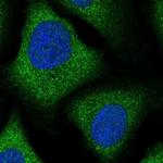 ZFP30 Polyclonal Antibody