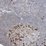 ZFP30 Antibody in Immunohistochemistry (Paraffin) (IHC (P))