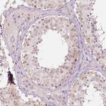 DLX6 Polyclonal Antibody