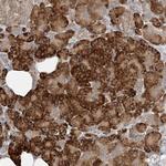 TMEM61 Polyclonal Antibody