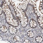 MAGEE2 Polyclonal Antibody