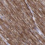 Sbk2 Antibody in Immunohistochemistry (Paraffin) (IHC (P))