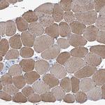 Sbk2 Antibody in Immunohistochemistry (Paraffin) (IHC (P))
