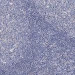 Sbk2 Antibody in Immunohistochemistry (Paraffin) (IHC (P))