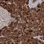 ZFP14 Antibody in Immunohistochemistry (Paraffin) (IHC (P))