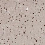 ZNF711 Antibody in Immunohistochemistry (IHC)