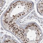 ZNF711 Antibody in Immunohistochemistry (IHC)