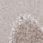 ZNF711 Antibody in Immunohistochemistry (IHC)