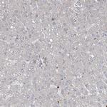 ZNF711 Antibody in Immunohistochemistry (IHC)