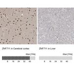 ZNF711 Antibody