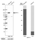 ZNF711 Antibody in Western Blot (WB)