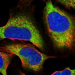 SAPS2 Polyclonal Antibody