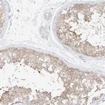 SAPS2 Antibody in Immunohistochemistry (IHC)