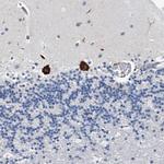 TMEM63C Antibody in Immunohistochemistry (Paraffin) (IHC (P))