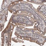 LACE1 Antibody in Immunohistochemistry (Paraffin) (IHC (P))