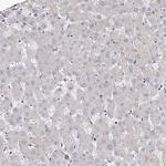 LACE1 Antibody in Immunohistochemistry (Paraffin) (IHC (P))